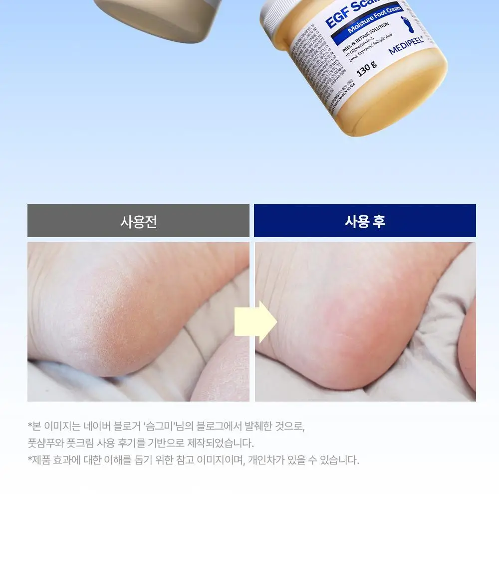 [베스트템] 메디필 EGF 스케일링 모이스처 버블 풋 샴푸 400ml 상세페이지 31